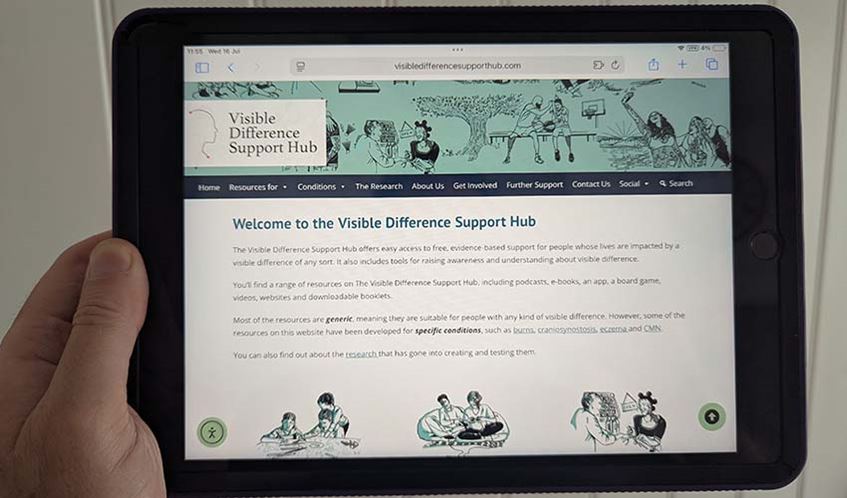 Person holding a tablet computer displaying the website Visible Difference Support Hub