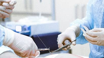 Mixed Reality and AI to aid surgeons with keyhole heart valve surgery