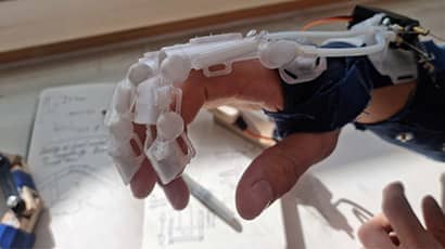 UWE Bristol student develops exoskeletal bionic glove to aid stroke recovery